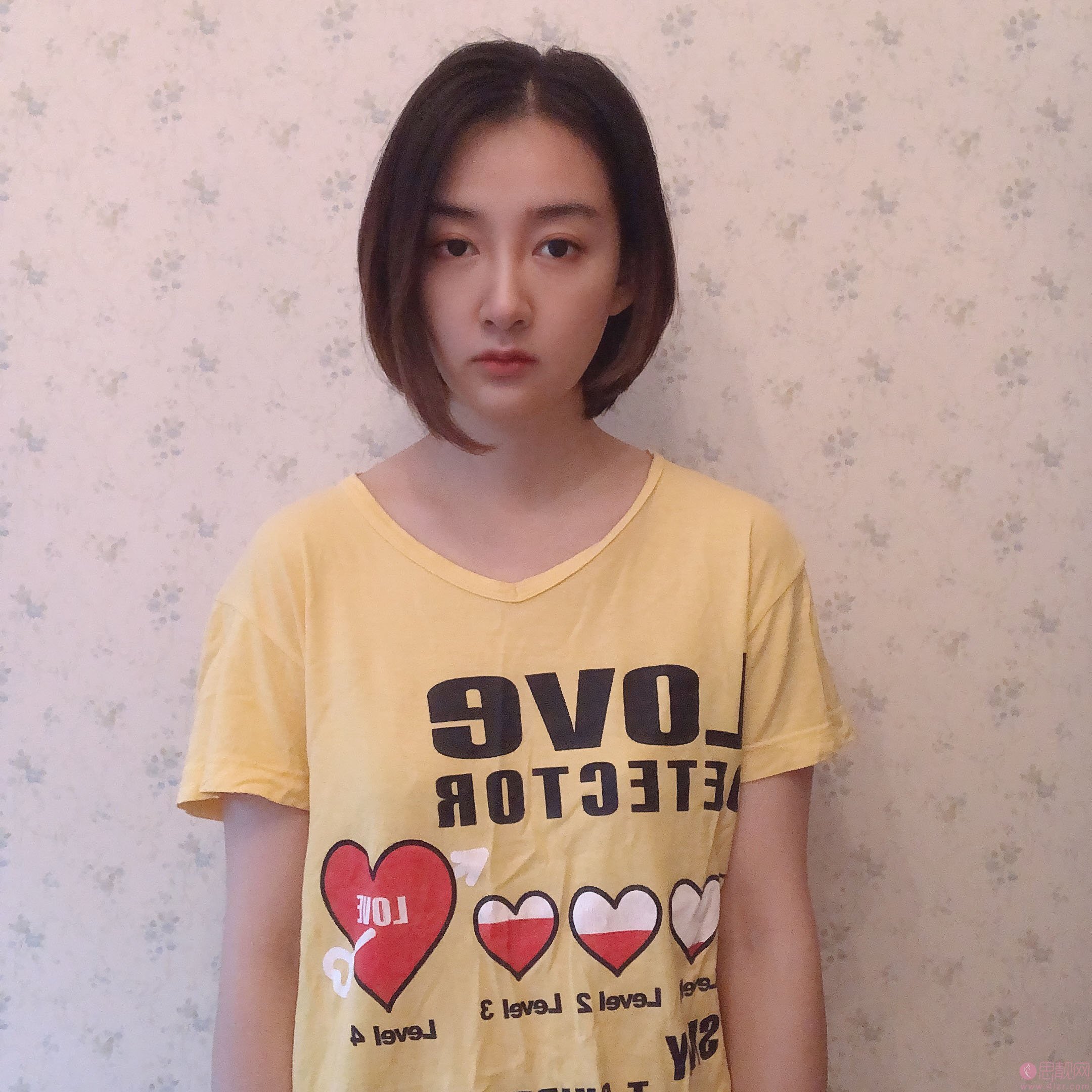 金华亚美整形美容邓泽臣隆胸怎么样？2020价格表一览+隆胸案例