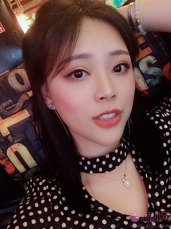 成都美芯东裕医疗美容整形雷元清做双眼皮怎么样?2020价格表一览