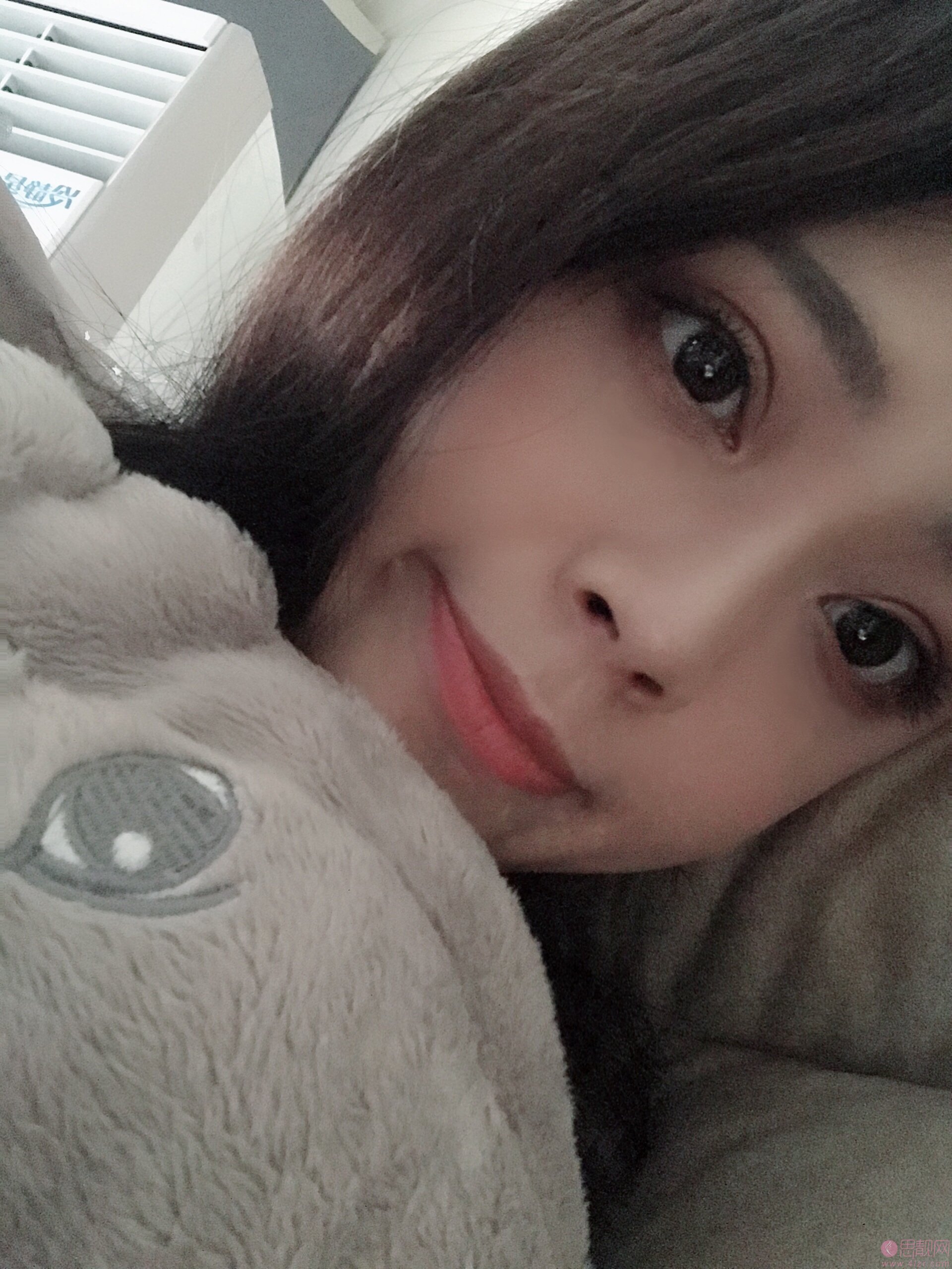 成都美芯东裕医疗美容整形雷元清做双眼皮怎么样?2020价格表一览