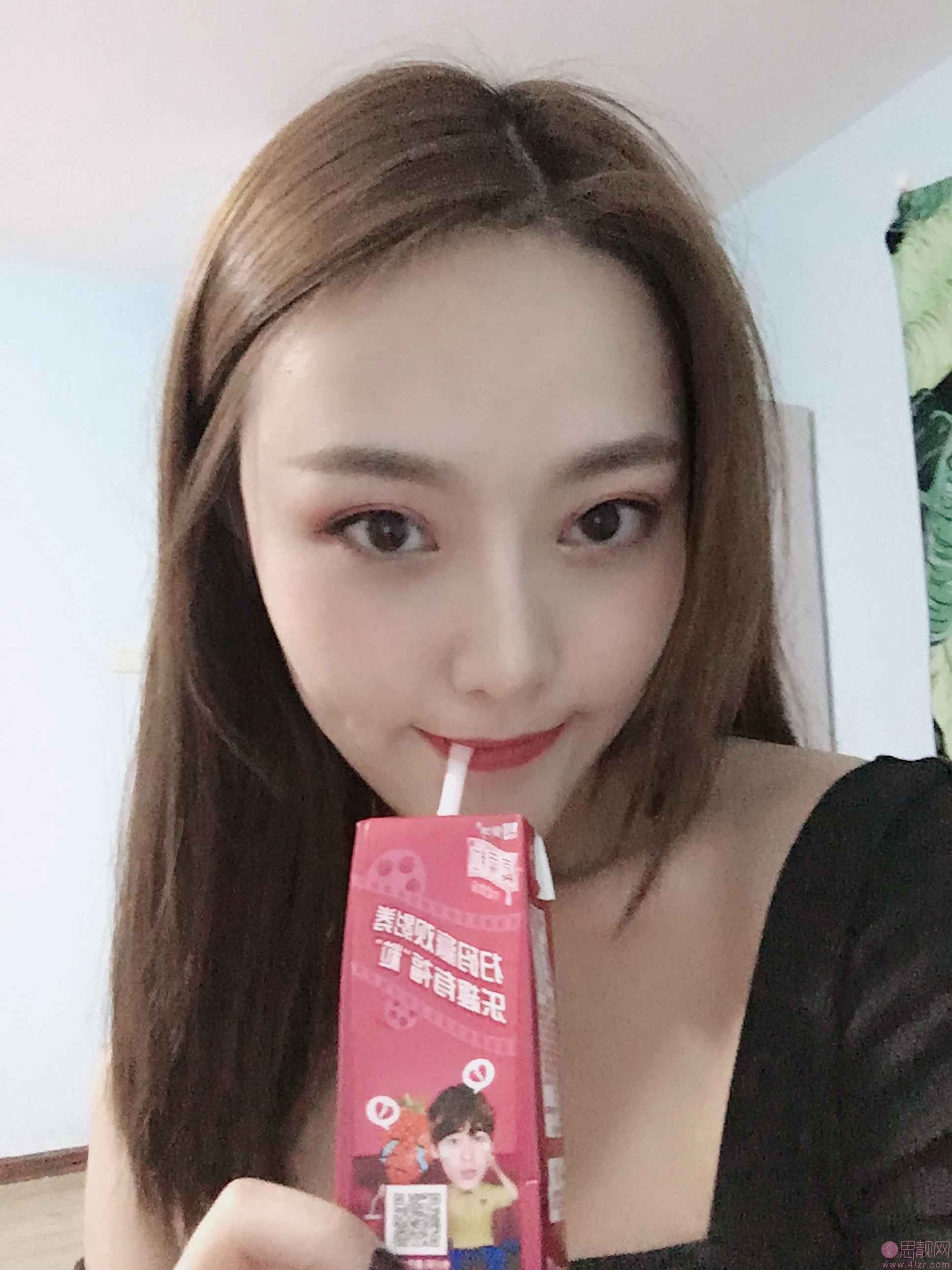 成都美绽美整形美容医院杨平做双眼皮怎么样？2020价格表一览