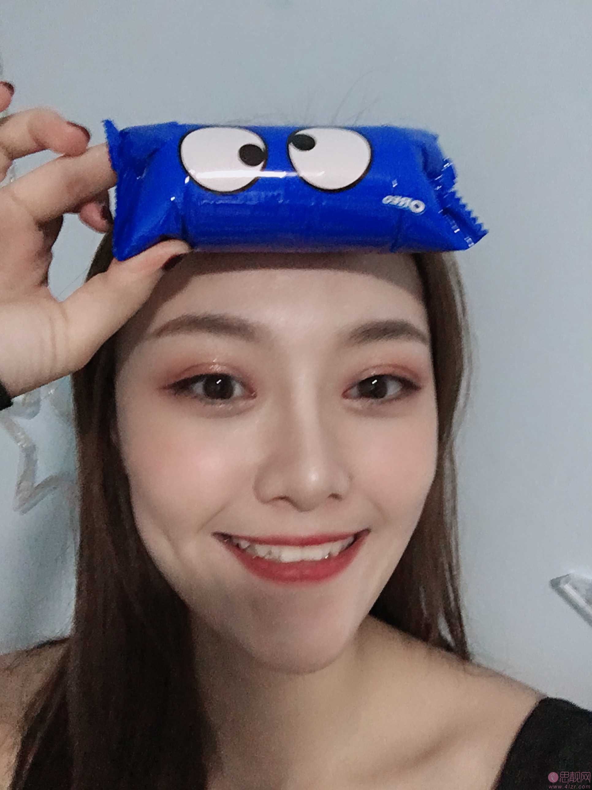 成都美绽美整形美容医院杨平做双眼皮怎么样？2020价格表一览