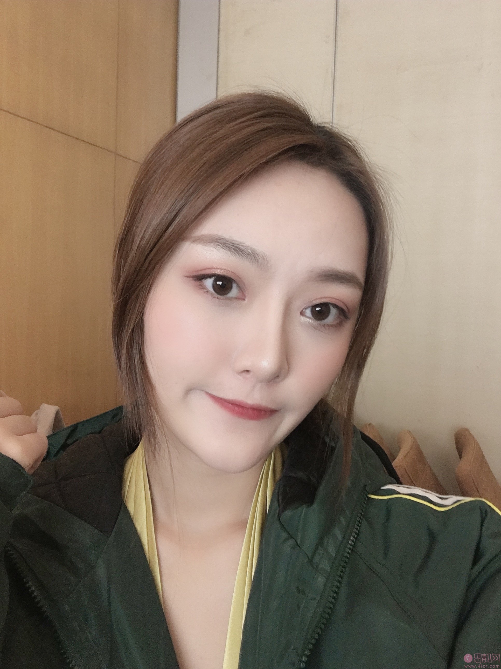 成都美绽美整形美容医院杨平做双眼皮怎么样？2020价格表一览