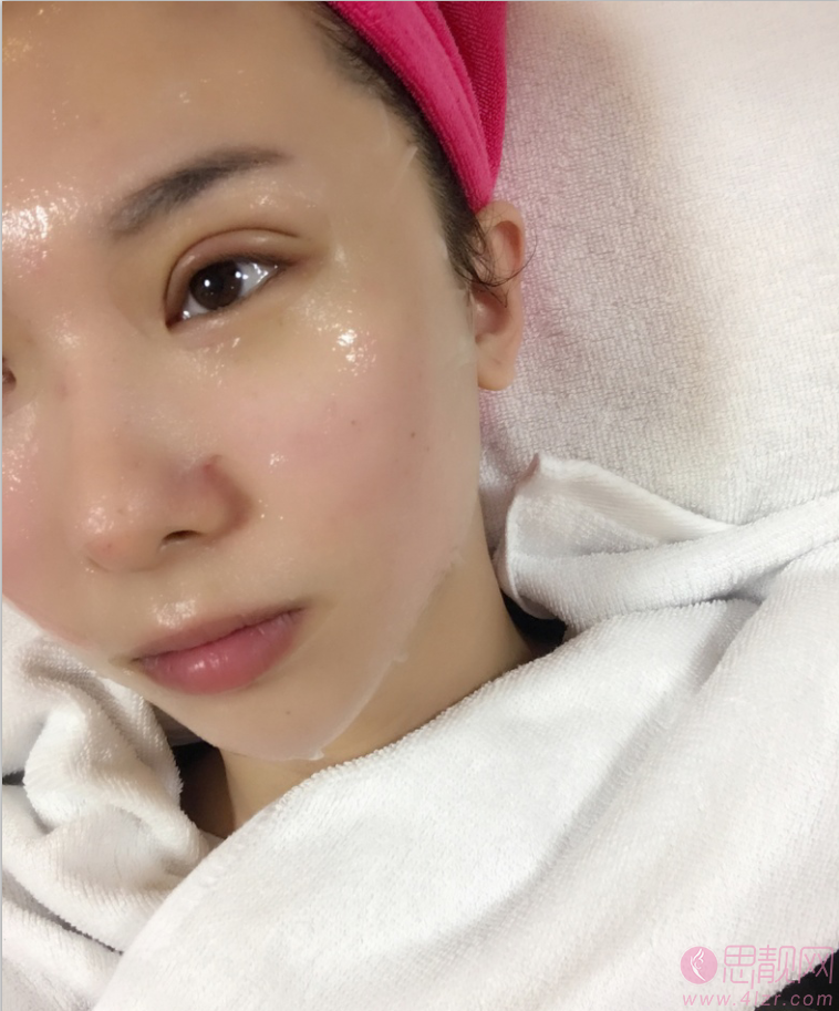 成都纽莱茵医疗美容孙熙东做双眼皮怎么样？2020价格表一览+双眼皮案例前后对比