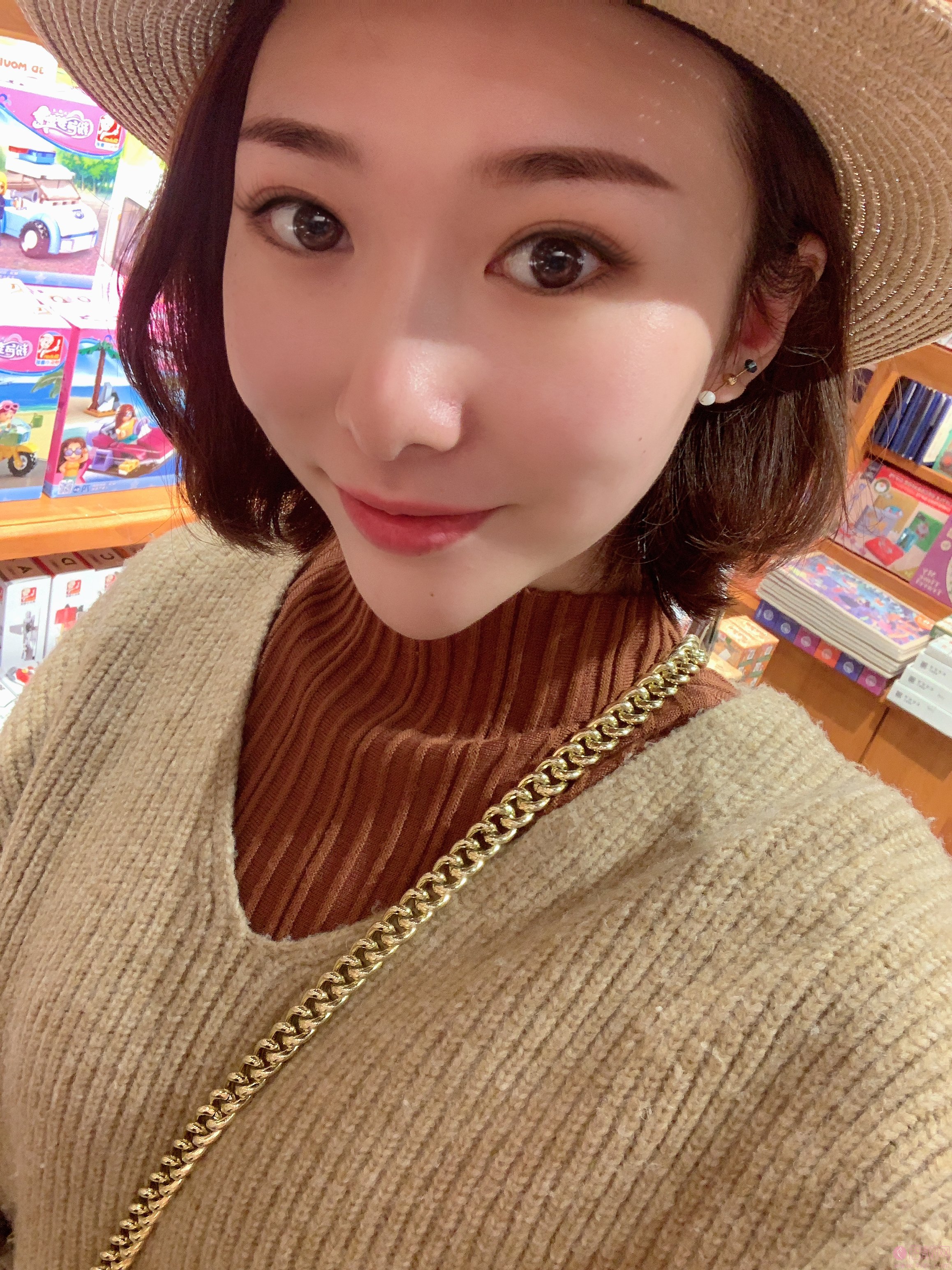 成都纽莱茵医疗美容孙熙东做双眼皮怎么样？2020价格表一览+双眼皮案例前后对比