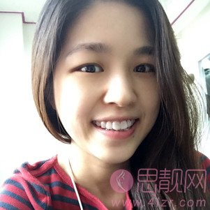 郑州植得口腔医院张玉璟牙齿隐形矫正怎么样？附矫正案例及2020最新价格表一览