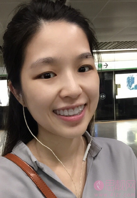 郑州植得口腔医院张玉璟牙齿隐形矫正怎么样？附矫正案例及2020最新价格表一览