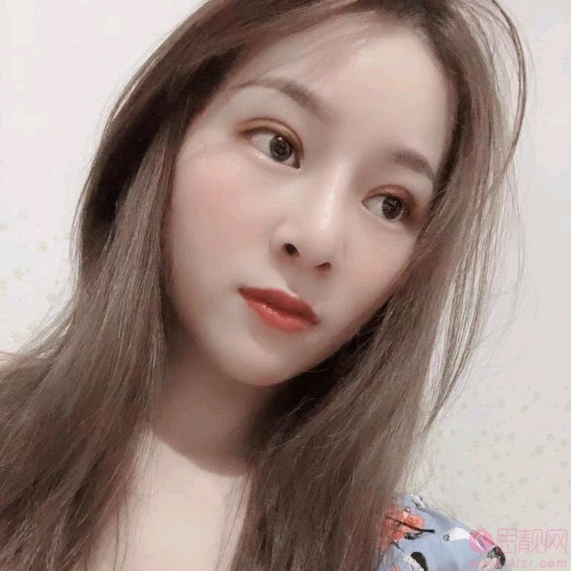 智美颜和医疗美容(外滩总院) 唐玲隆鼻怎么样？附隆鼻前后对比案例及2020价格表一览
