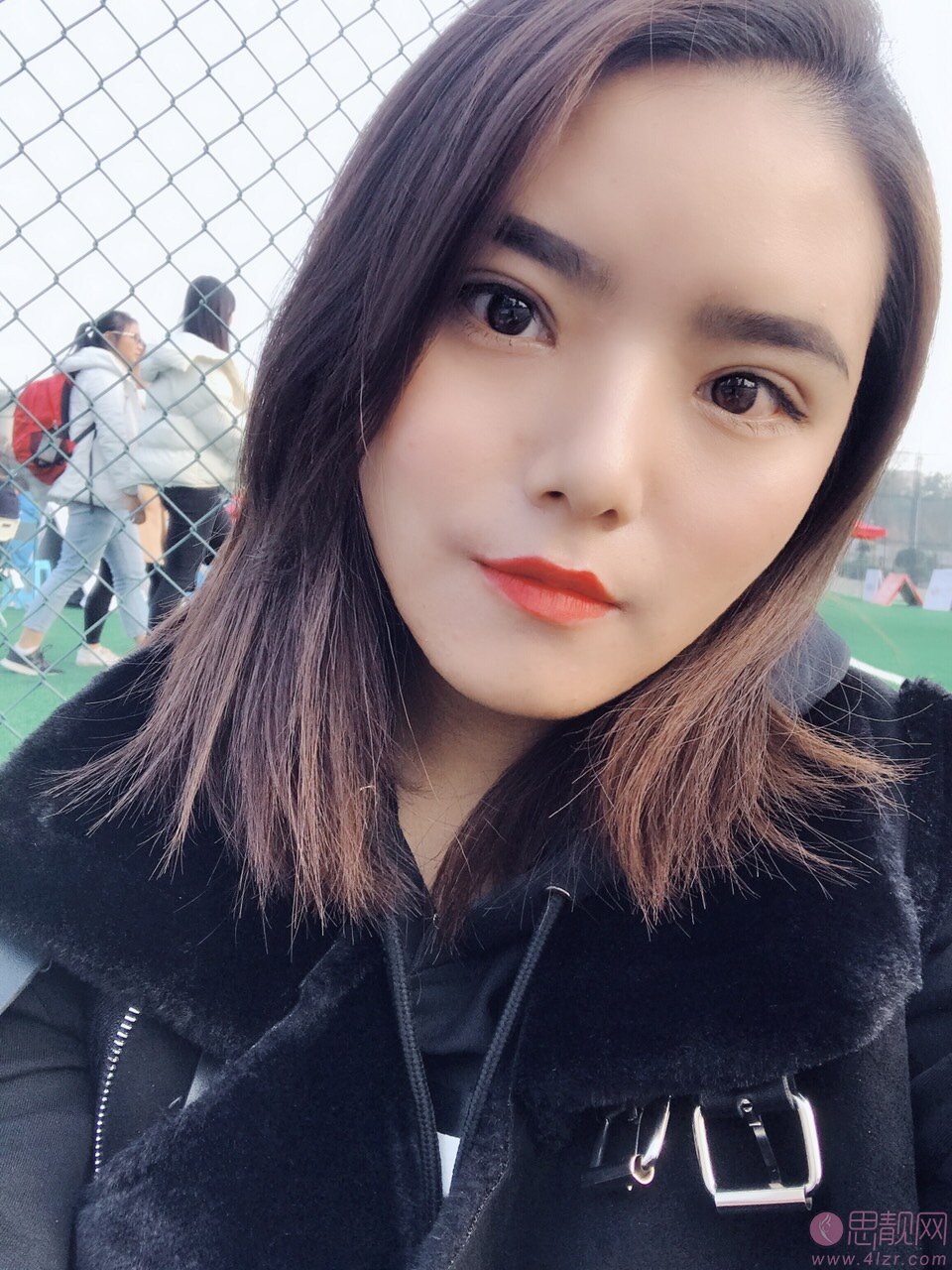 成都百龄医疗美容整形医院王超做双眼皮怎么样？附双眼皮案例一览+2020价格表曝光