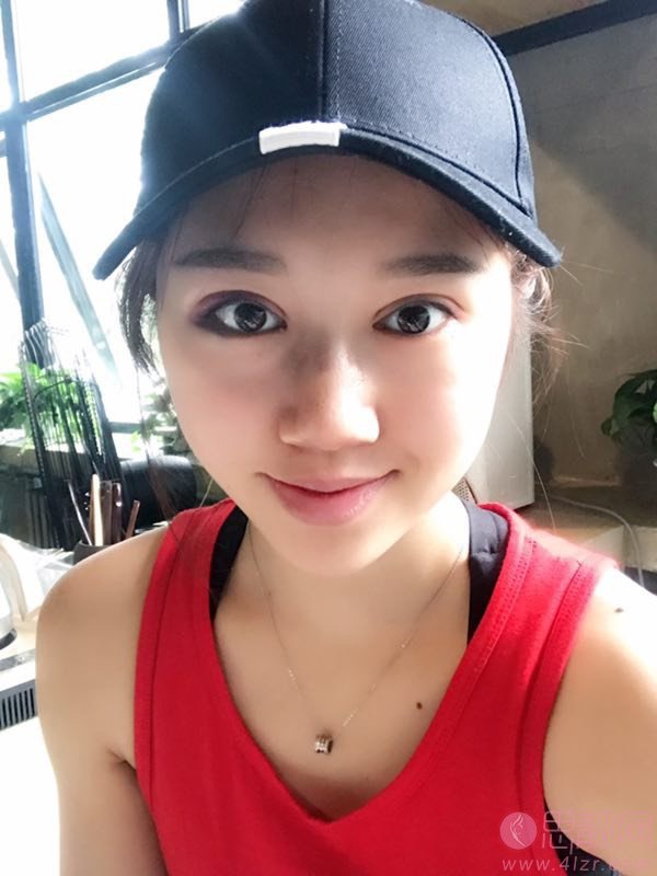 遵义利美康美容医院唐芳明做双眼皮怎么样?附双眼皮案例一览+2020价格表出炉