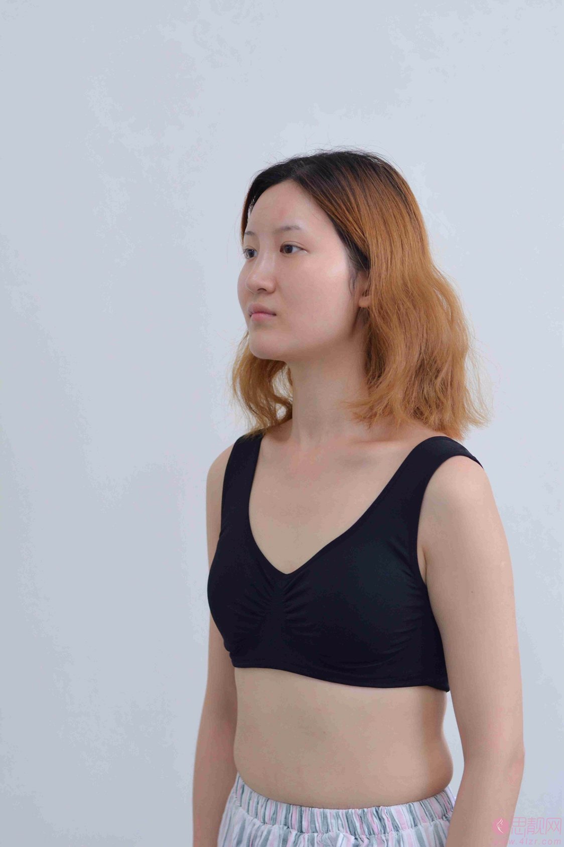 四川美莱医学美容医院吴江山做假体隆胸怎么样？附假体隆胸案例对比及2020价格表一览