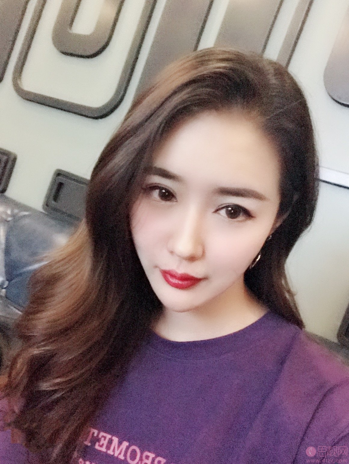 厦门长庚医院整形美容科2020价格表一览+双眼皮案例效果展示