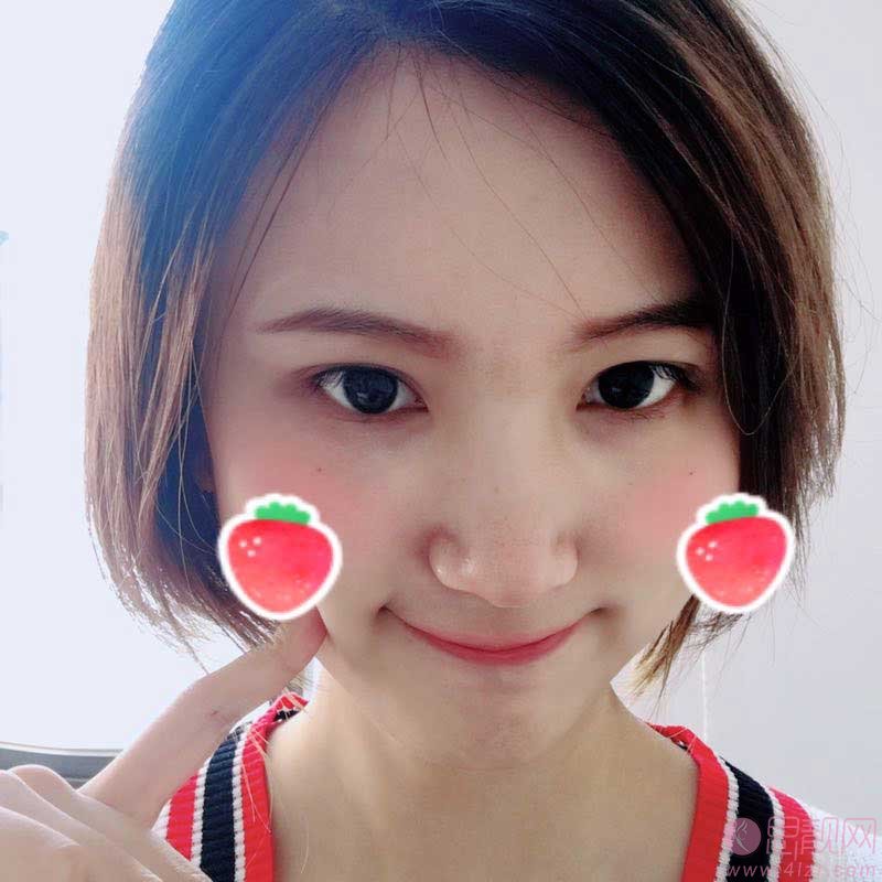 厦门思明云艺美整形外科门诊部刘爱茹祛眼袋怎么样?2020价格表一览+祛眼袋前后对比