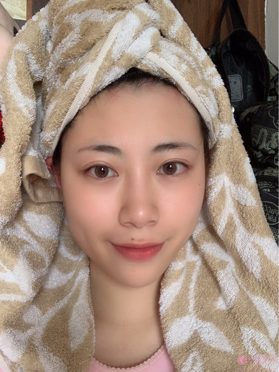 厦门酉西儿医疗美容庄锦波隆鼻怎么样？附隆鼻案例对比及2020价格表