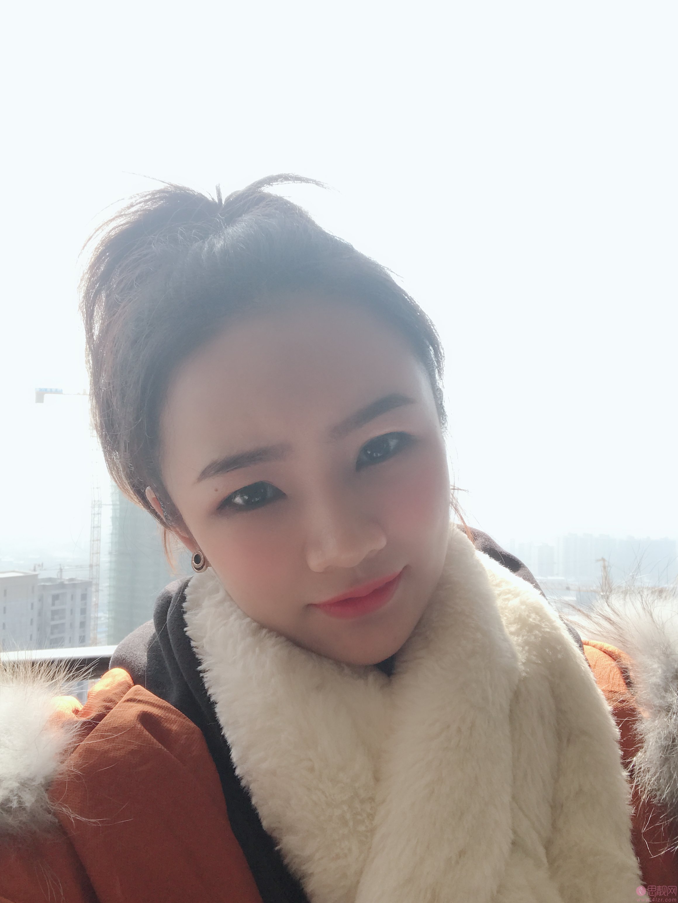 厦门银河整形外科门诊部柴天举自体脂肪填充全脸怎么样？2020价格表一览+填充案例分享