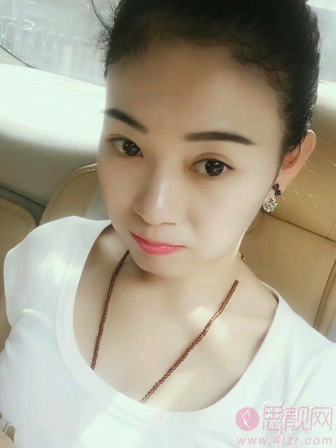 厦门伊美整形美容门诊部祛痘怎么样?附祛痘案例对比及2020价格表曝光