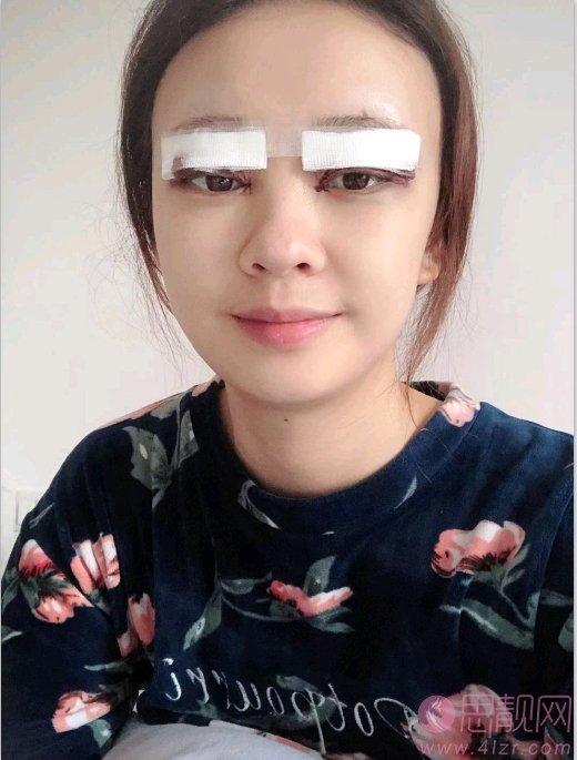 厦门新开元医疗美容门诊部做双眼皮怎么样？2020最新价格表一览