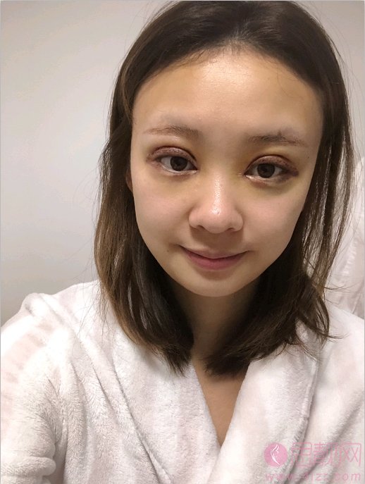 厦门新开元医疗美容门诊部做双眼皮怎么样？2020最新价格表一览