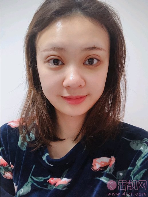 厦门新开元医疗美容门诊部做双眼皮怎么样？2020最新价格表一览