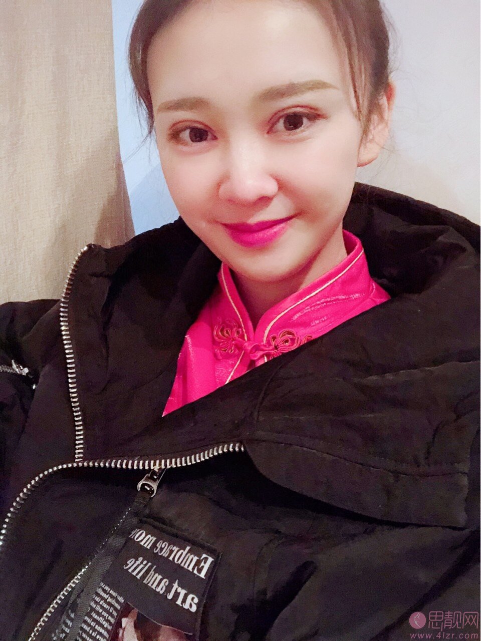 厦门新开元医疗美容门诊部做双眼皮怎么样？2020最新价格表一览