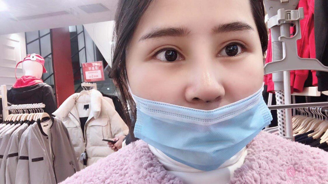 成都鹏爱悦己医疗美容医院隆鼻怎么样?附隆鼻案例及2020价格表一览