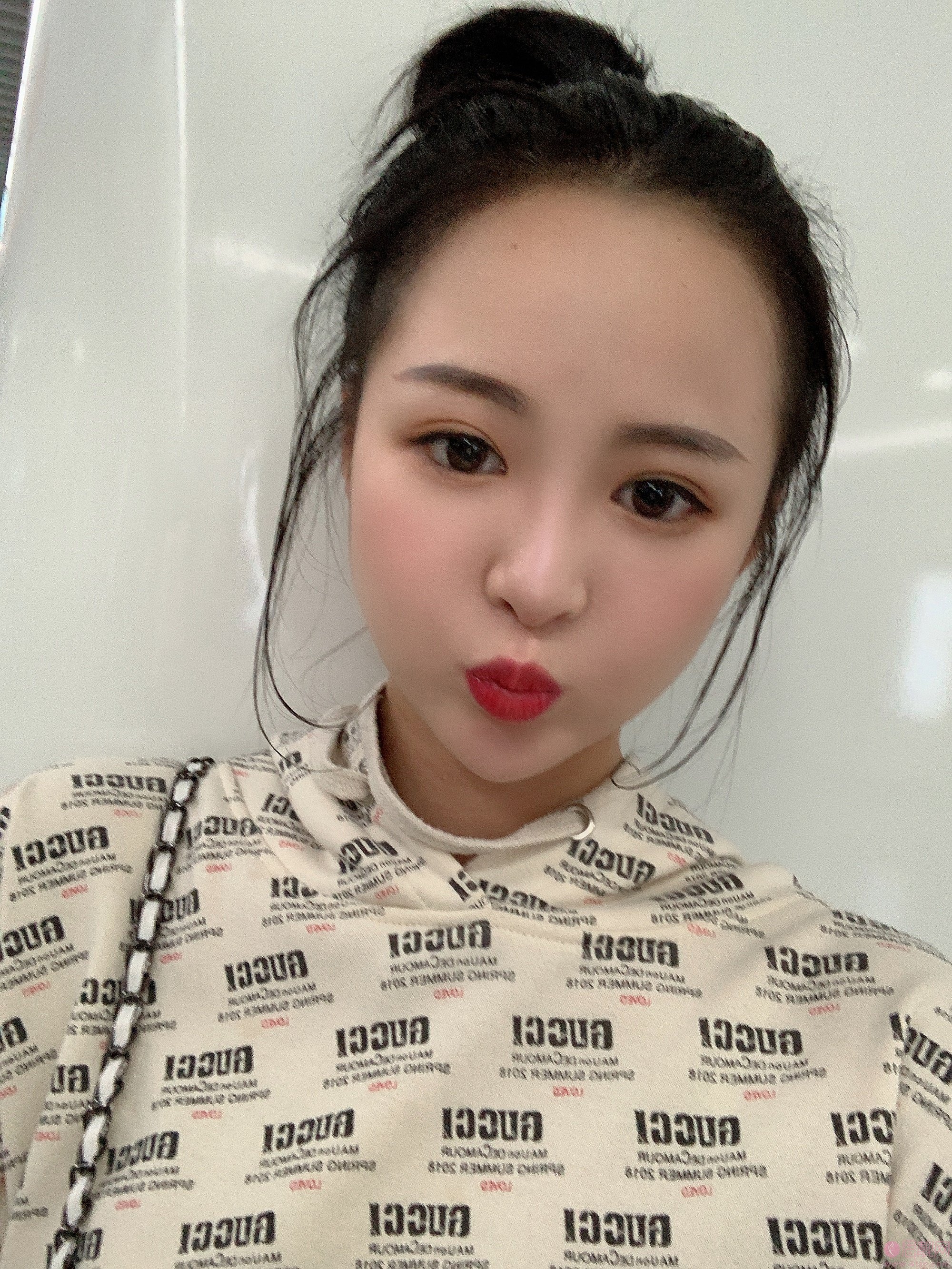 成都赵善军博士整形自体脂肪全脸填充好不好?2020价格表出炉+填充案例前后对比