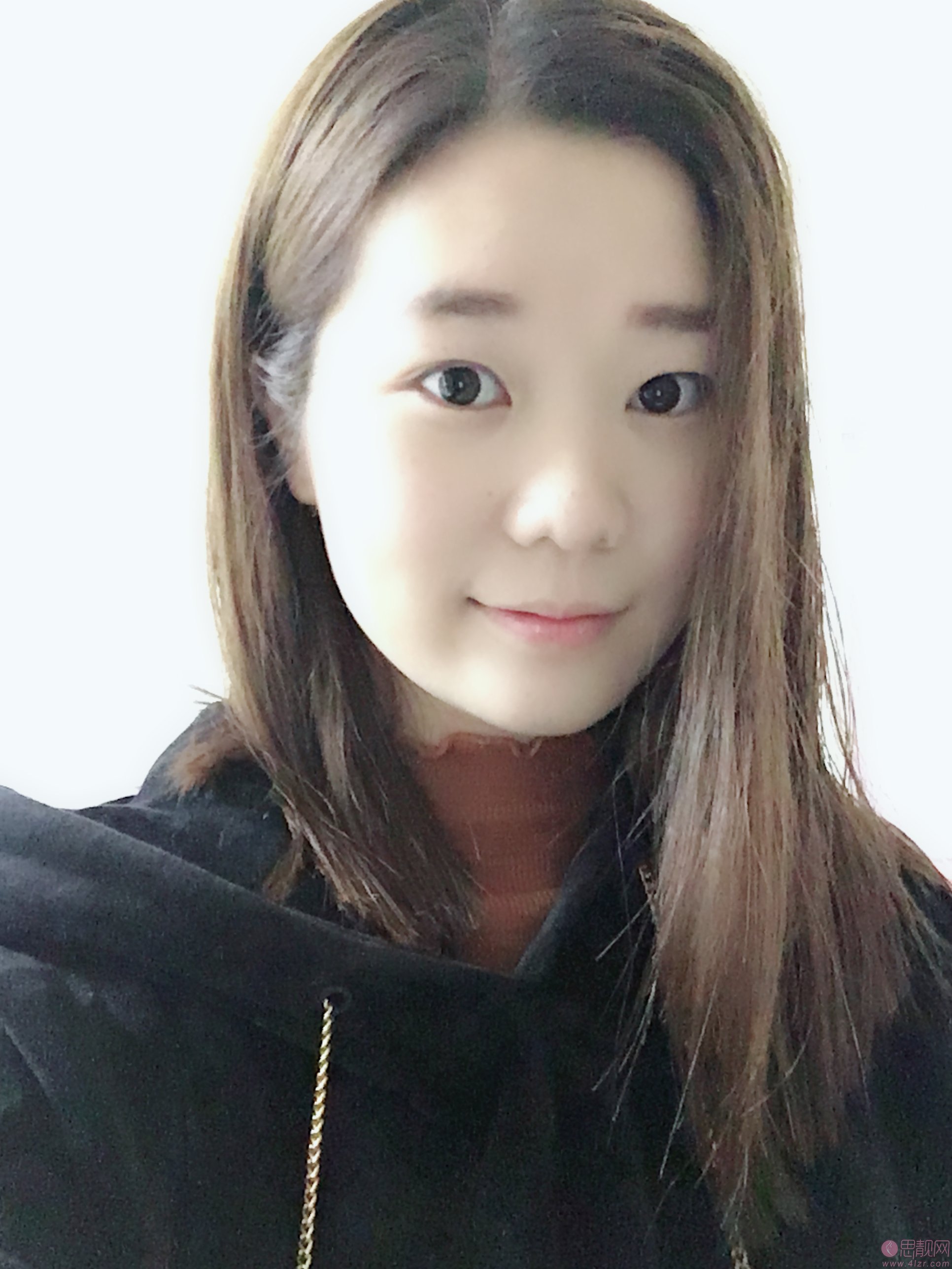 福州痘博士专业祛痘怎么样?2020价格表出炉