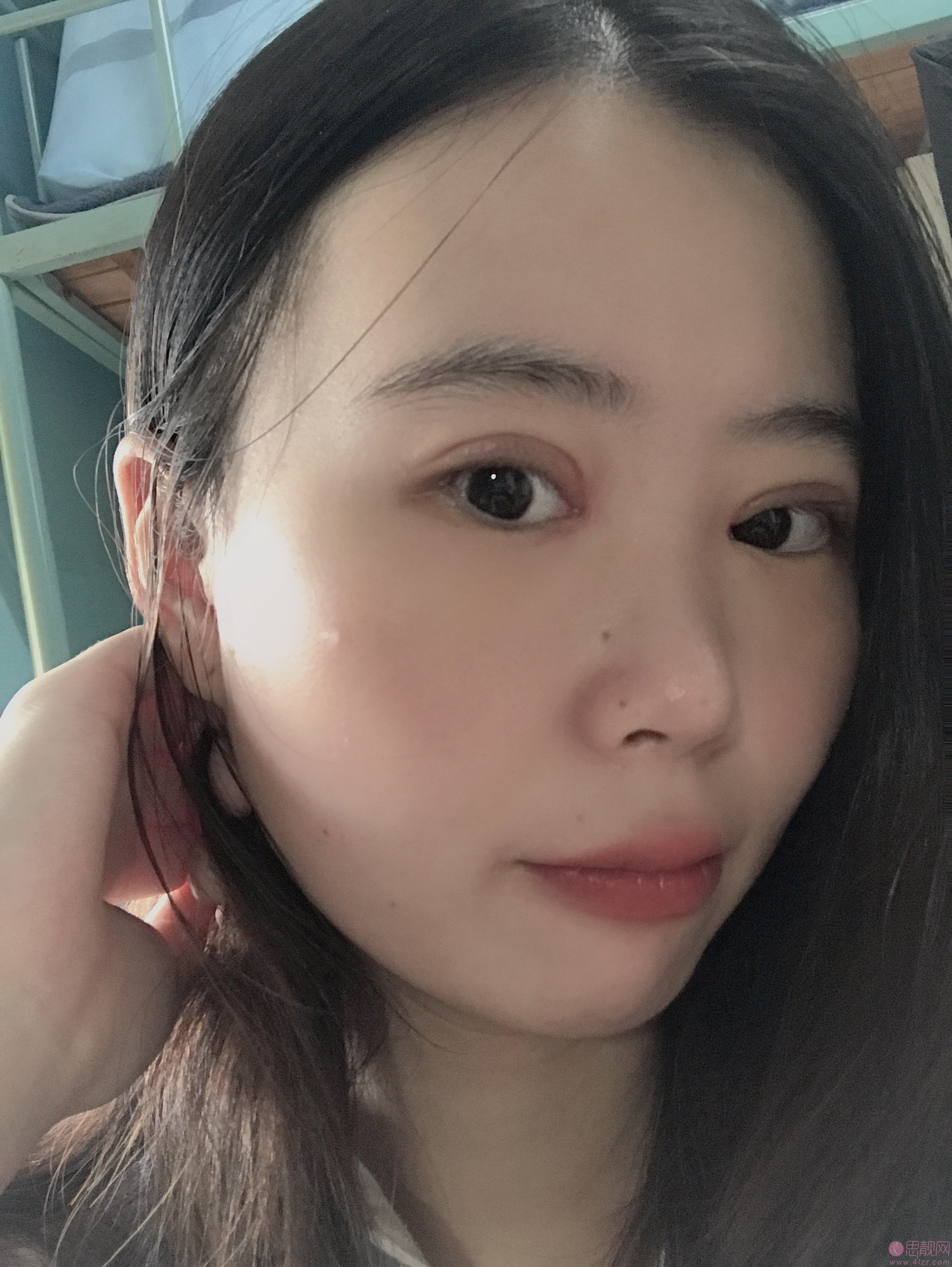 福州格莱美美容医院任正义做双眼皮怎么样?附2020价格表一览+双眼皮案例对比
