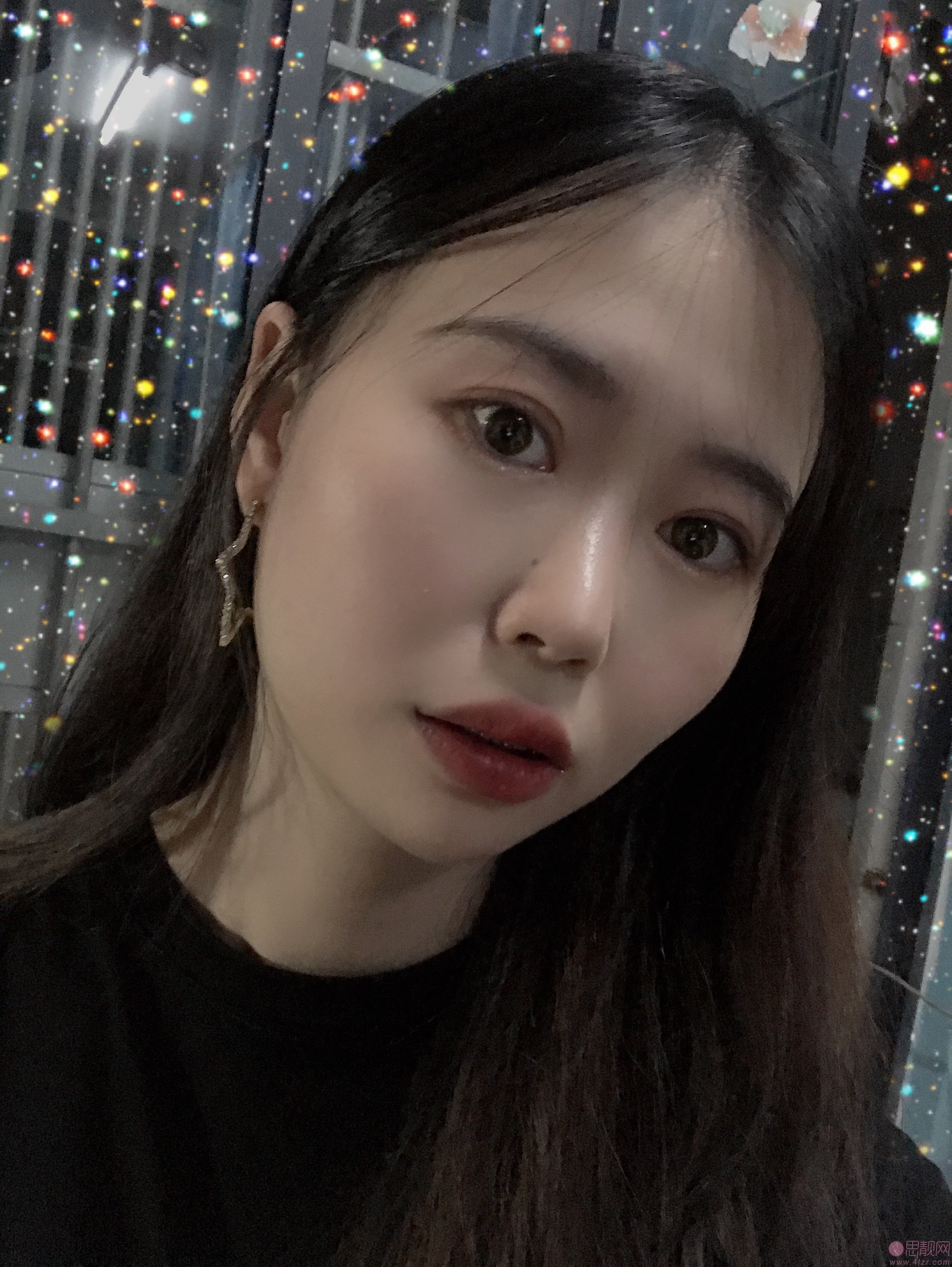 福州格莱美美容医院任正义做双眼皮怎么样?附2020价格表一览+双眼皮案例对比