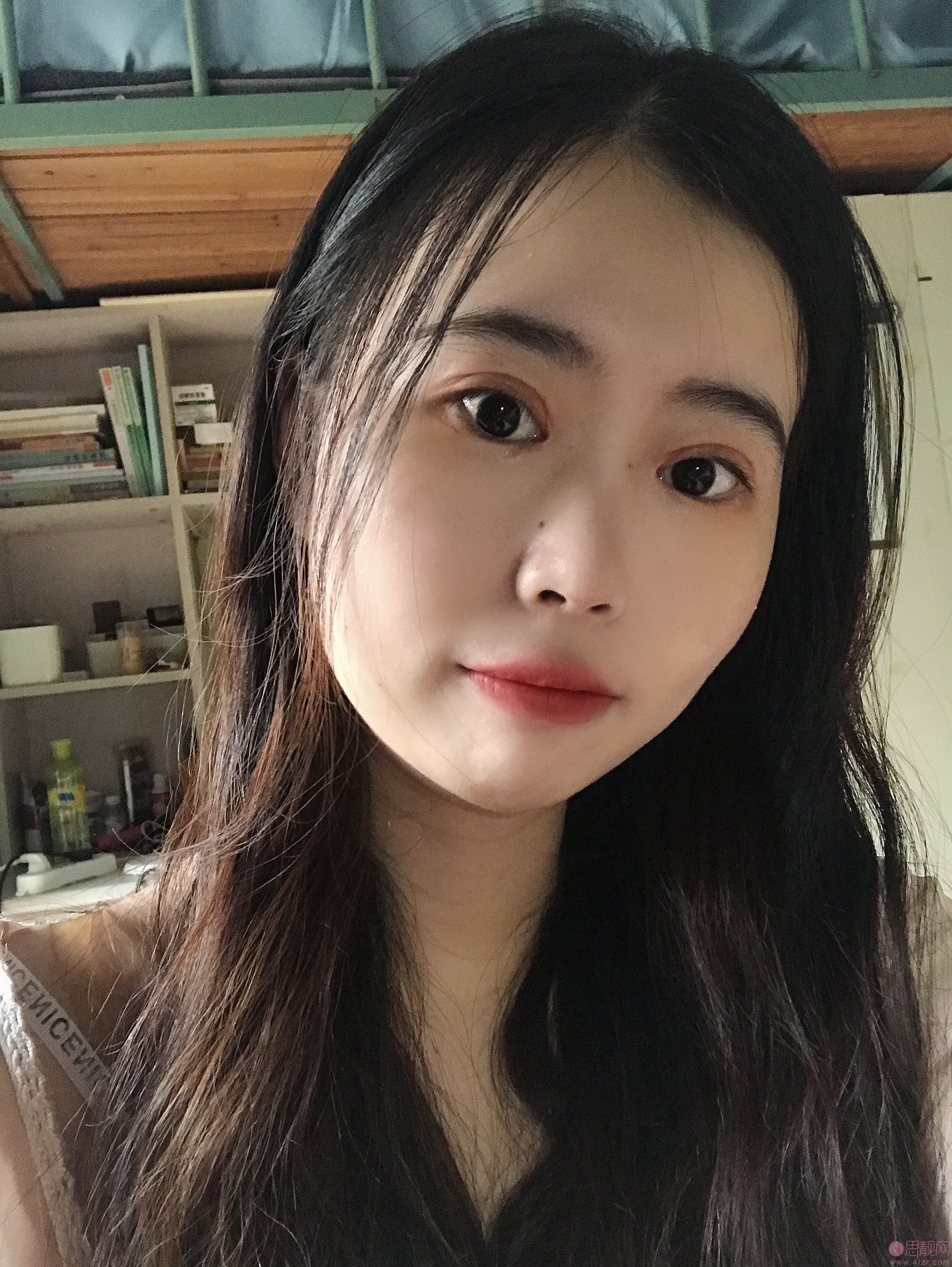 福州格莱美美容医院任正义做双眼皮怎么样?附2020价格表一览+双眼皮案例对比
