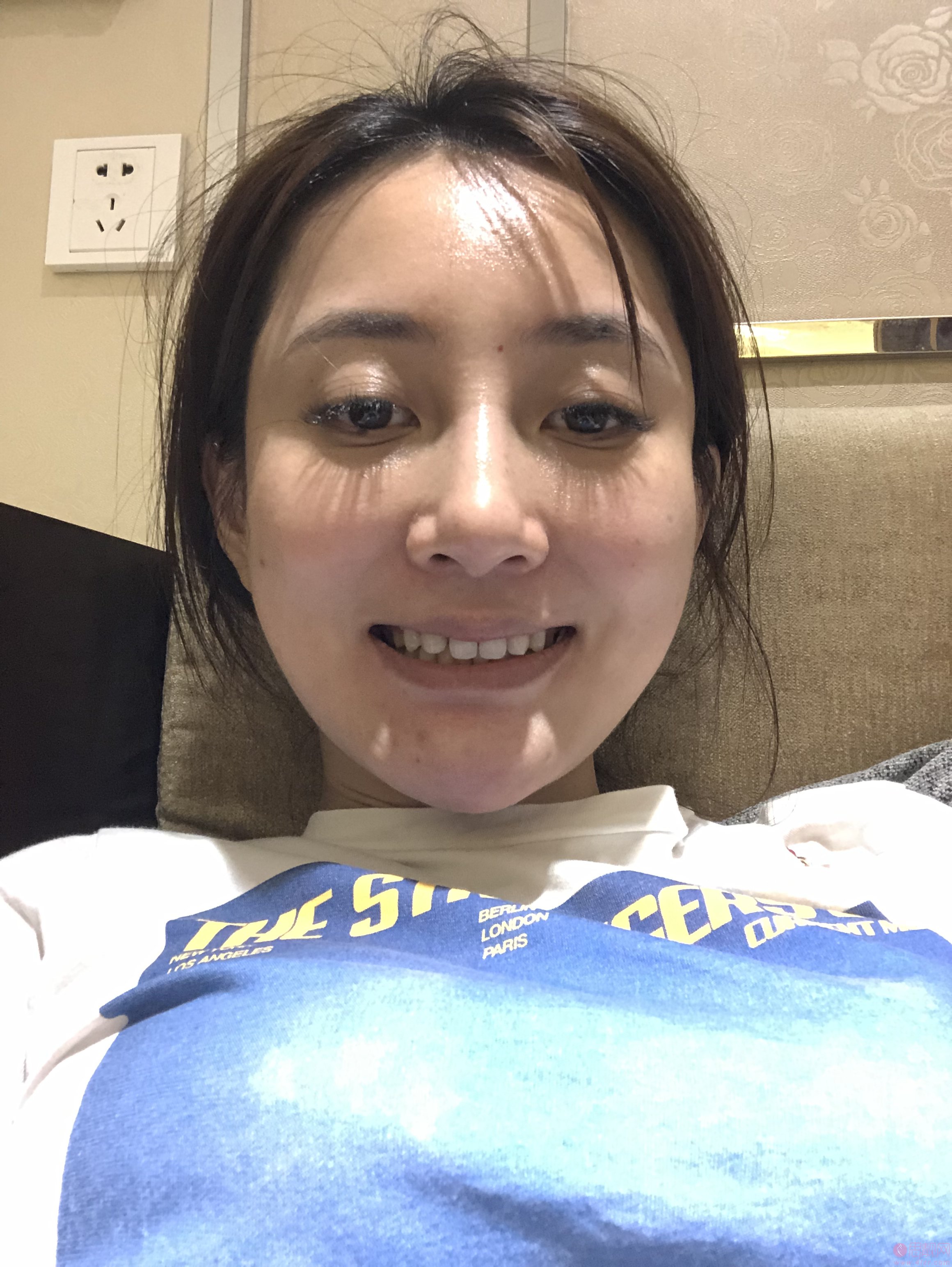 北京固德金冠口腔门诊部张娟牙齿美白怎么样?附牙齿美白案例及2020全新价格表上线