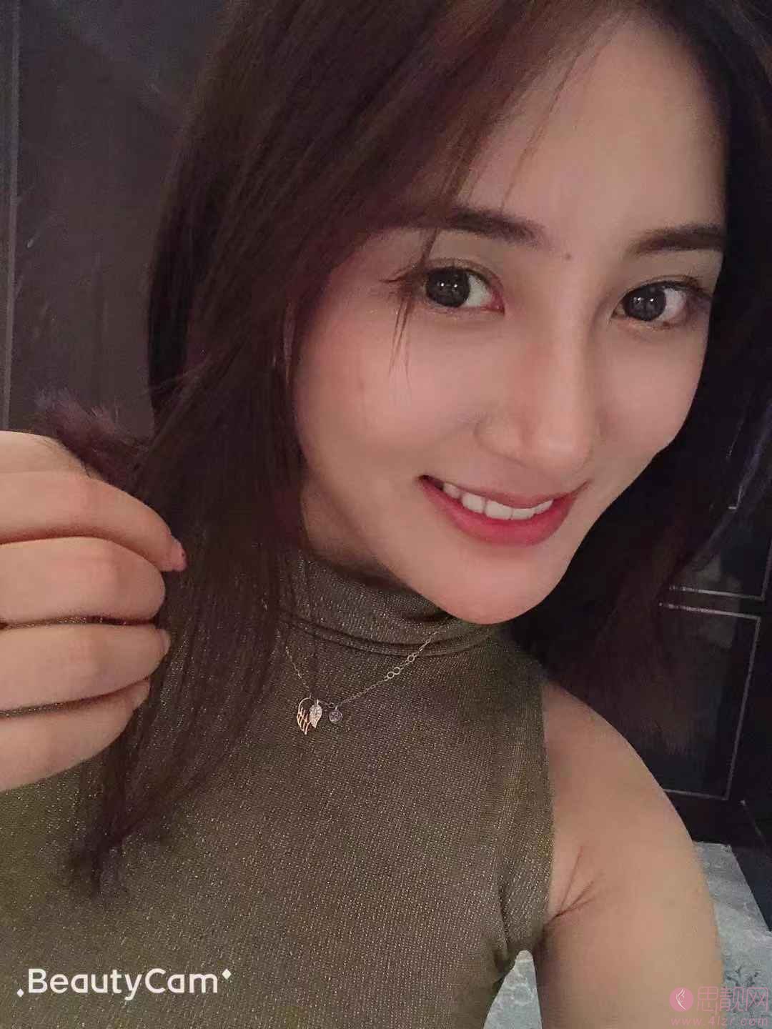 北京固德金冠口腔门诊部张娟牙齿美白怎么样?附牙齿美白案例及2020全新价格表上线