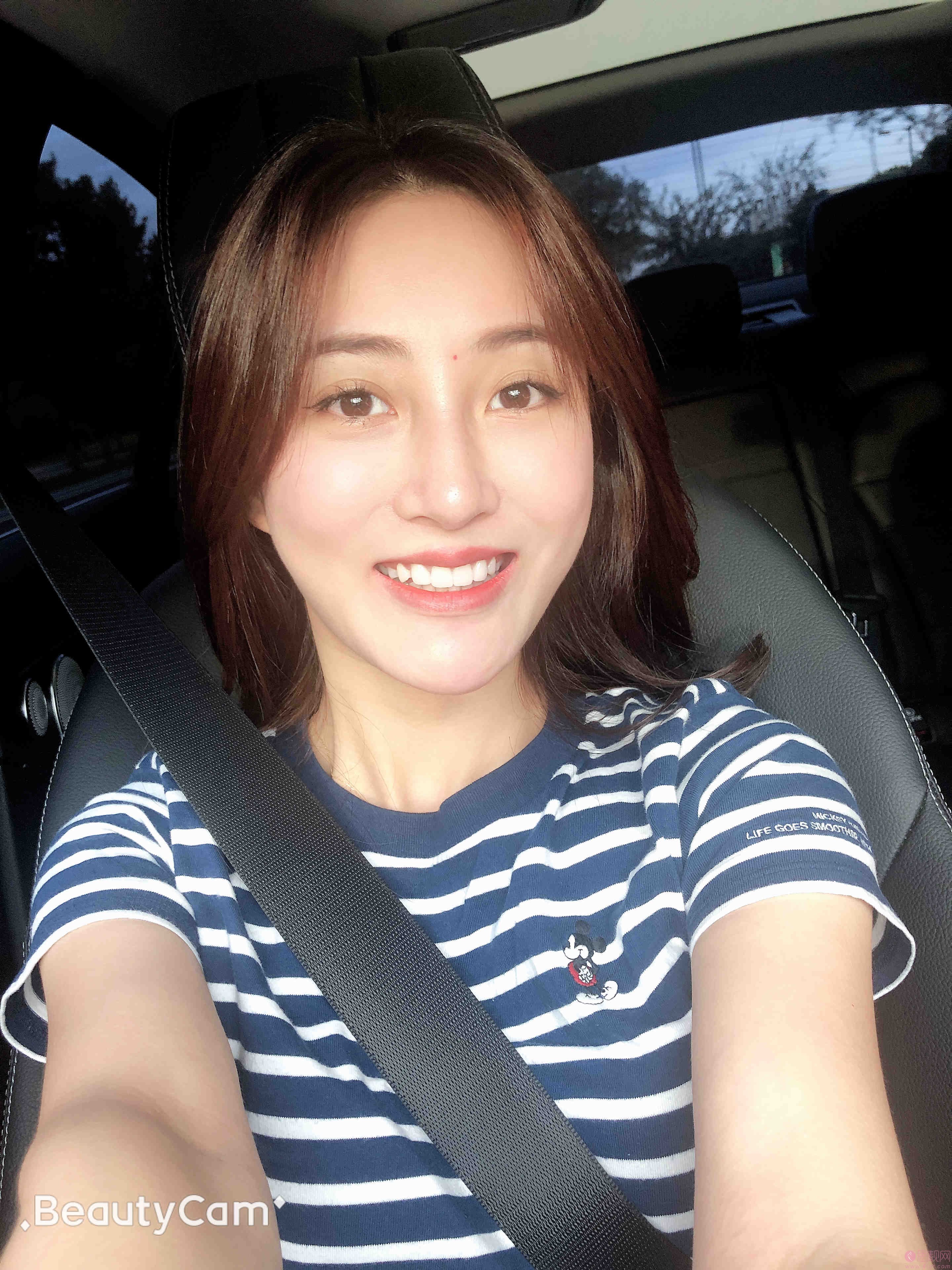 北京固德金冠口腔门诊部张娟牙齿美白怎么样?附牙齿美白案例及2020全新价格表上线