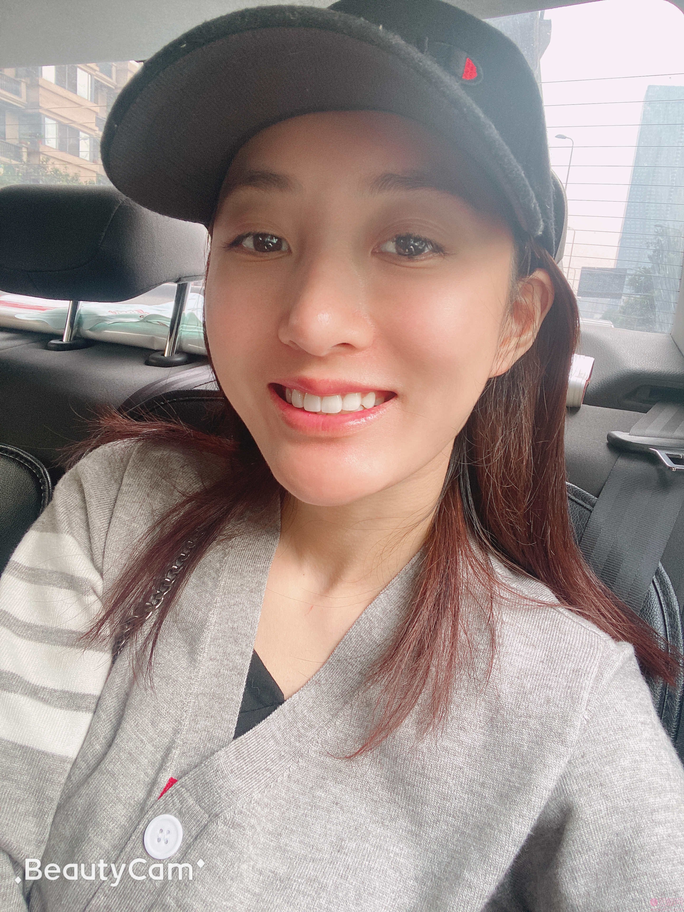 北京固德金冠口腔门诊部张娟牙齿美白怎么样?附牙齿美白案例及2020全新价格表上线