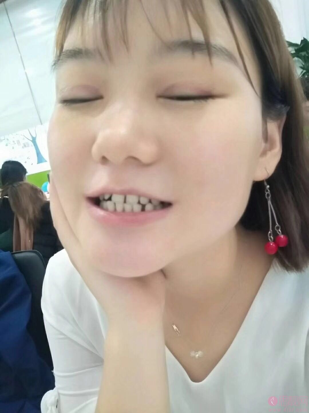 北京瑞齿口腔姜涛医生隐形矫正怎么样？附矫正前后案例对比及2020最新价格表一览