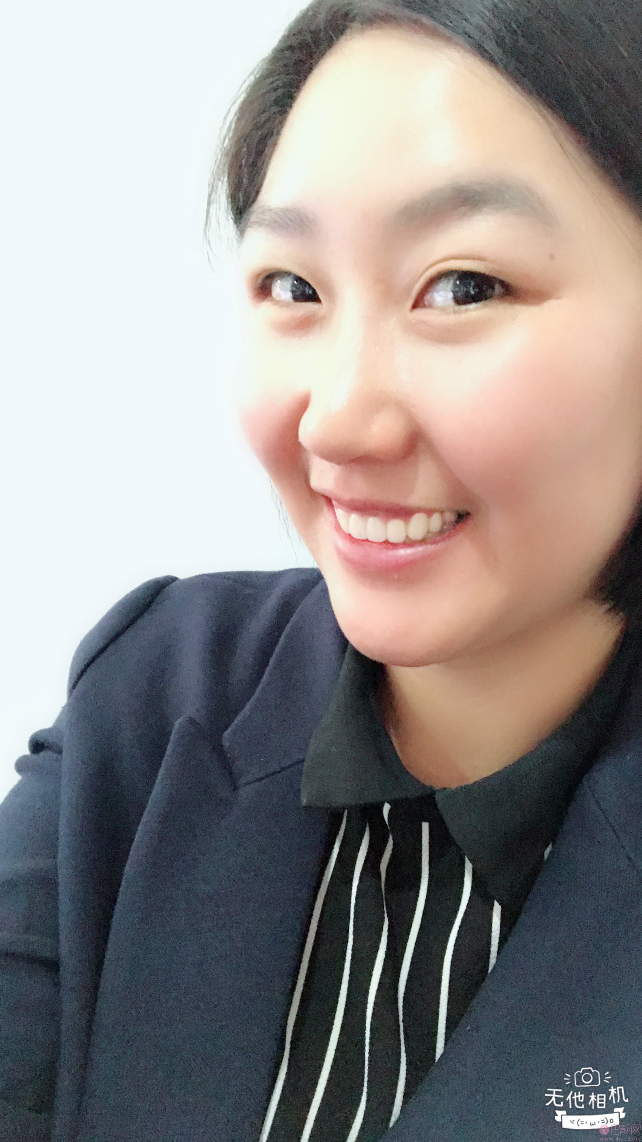北京泰固金冠口腔诊所闫敏瓷贴面怎么样、附瓷贴面真人分享及2020价格表一览