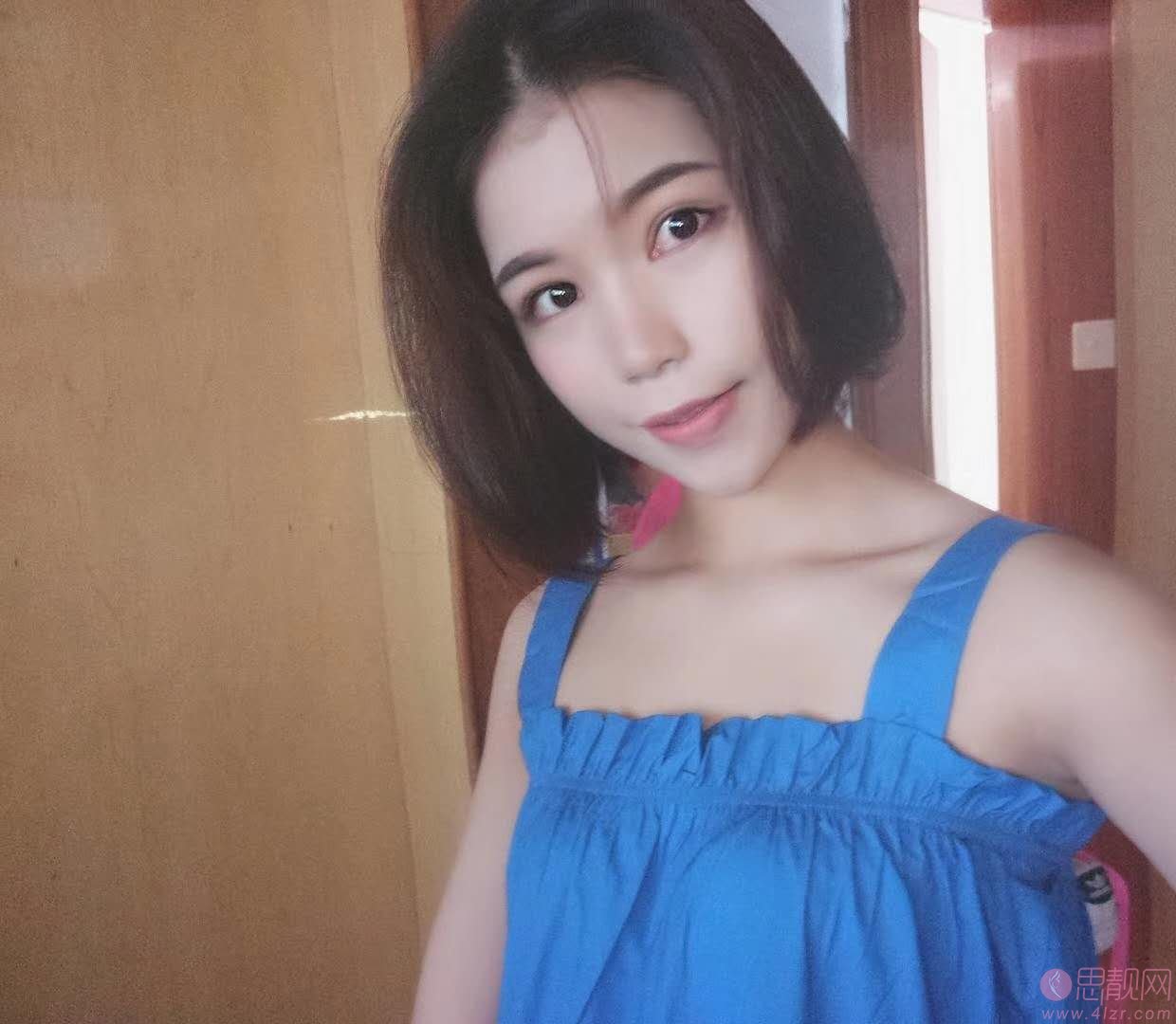 福州西美整形做双眼皮怎么样?附双眼皮案例及2020价格表一览