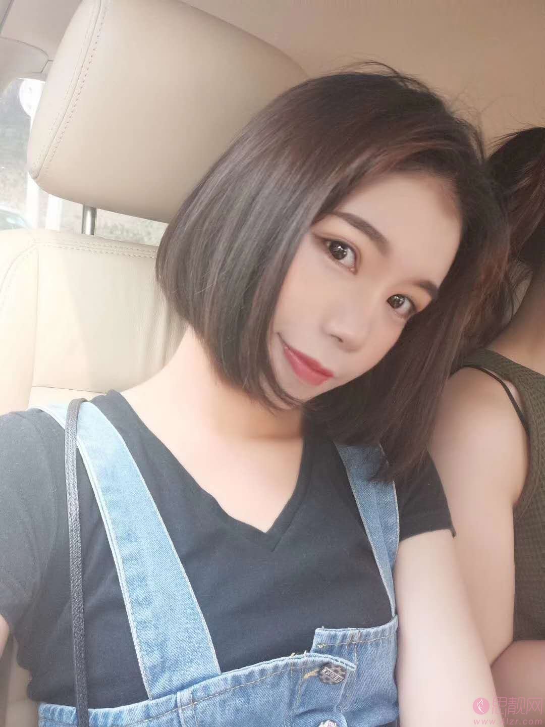 福州西美整形做双眼皮怎么样?附双眼皮案例及2020价格表一览