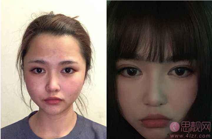 福州新时代整形美容怎么样？附医院简介及2020全新价格表上线
