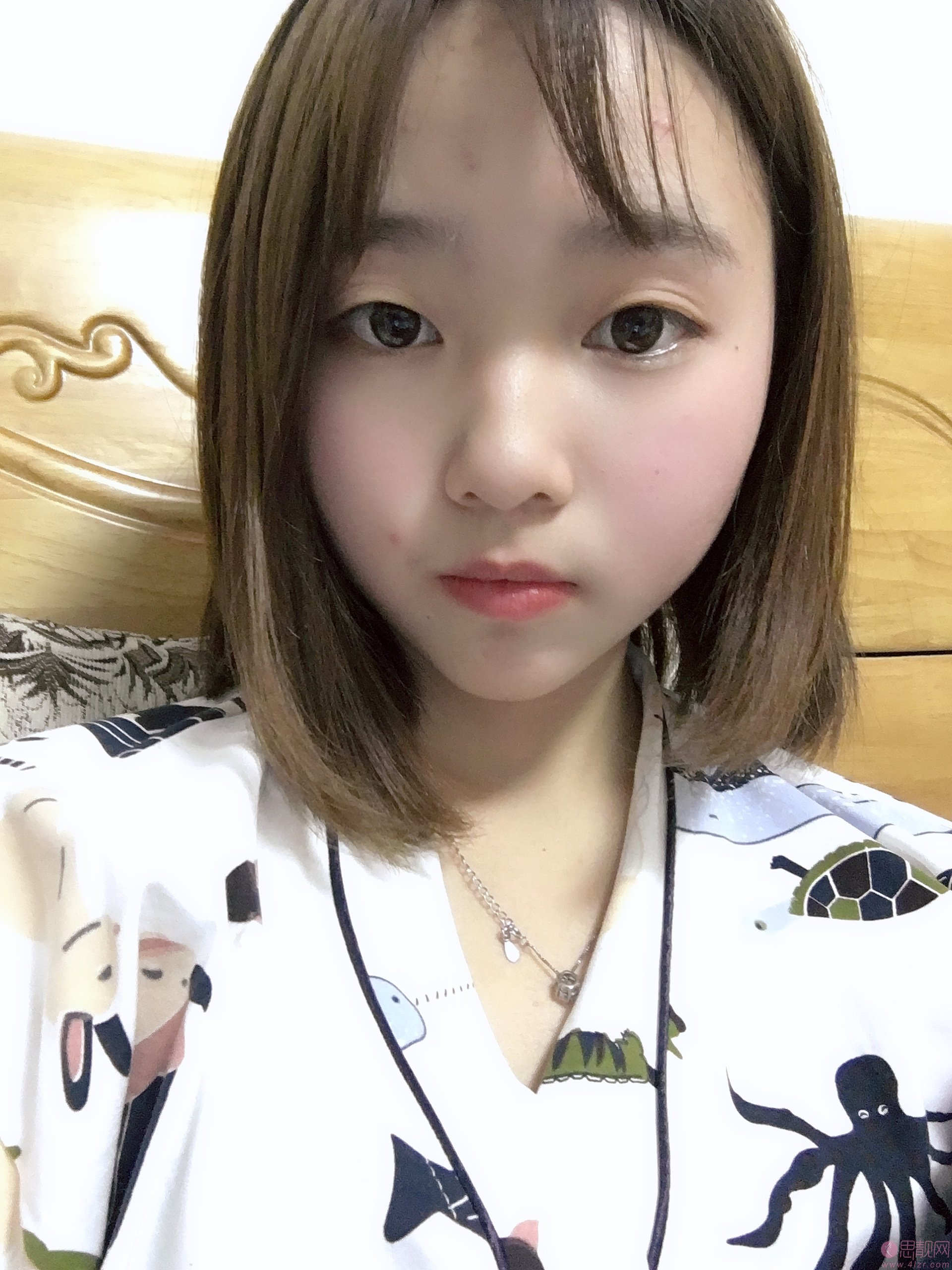 福州鼓楼伊美新世纪整形外科门诊部邹克文做双眼皮怎么样》附双眼皮案例一览及2020价格表