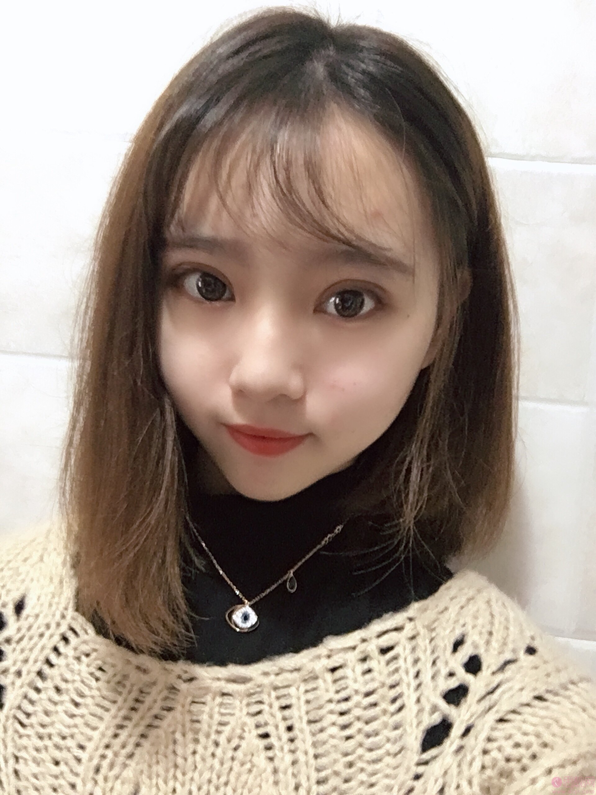 福州鼓楼伊美新世纪整形外科门诊部邹克文做双眼皮怎么样》附双眼皮案例一览及2020价格表