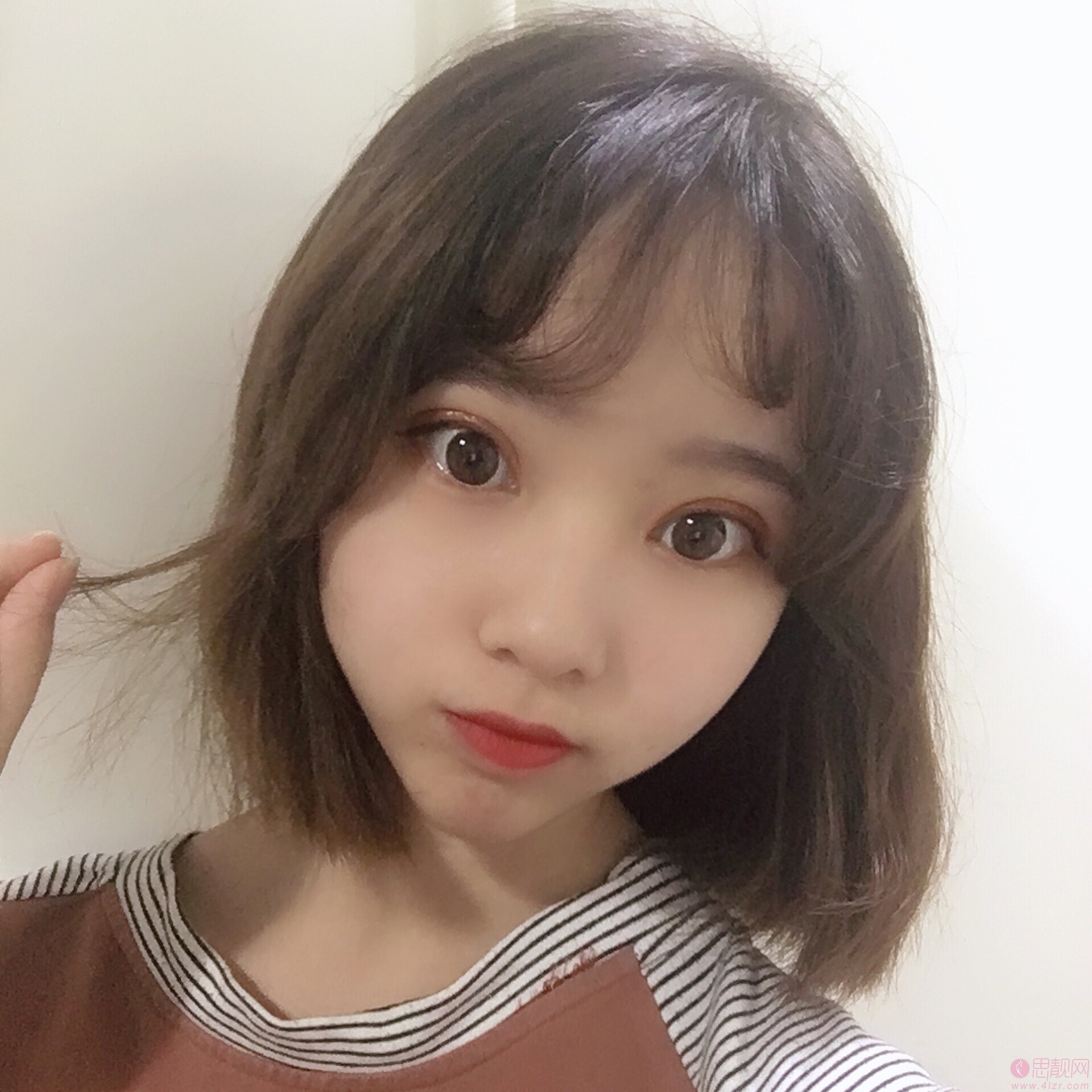 福州鼓楼伊美新世纪整形外科门诊部邹克文做双眼皮怎么样》附双眼皮案例一览及2020价格表