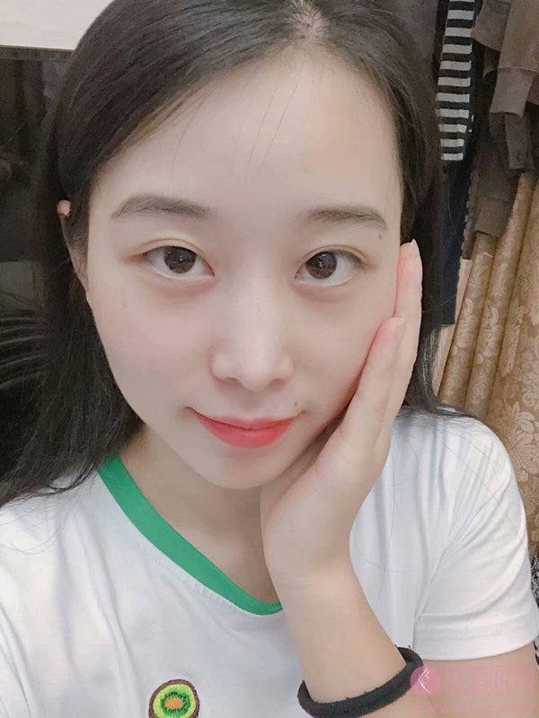 东莞南城固德口腔门诊部有限公司何继帅口腔矫正怎么样？附矫正案例及2020价格表一览