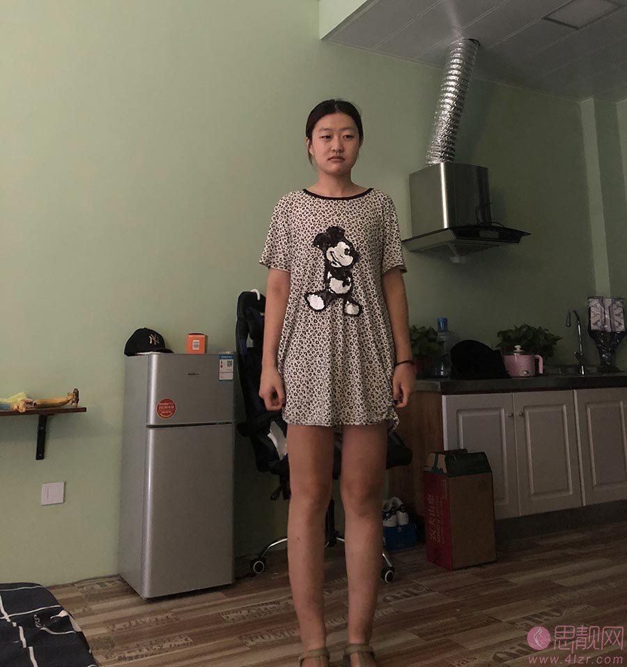 厦门黄岩整形外科门诊部黄志文吸脂怎么样？附吸脂案例及2020价格表一览