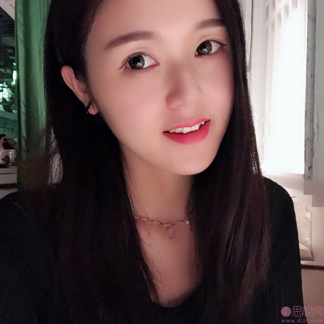 佛山华美口腔邵万村牙齿矫正怎么样？附矫正案例一览+2020全新价格表曝光