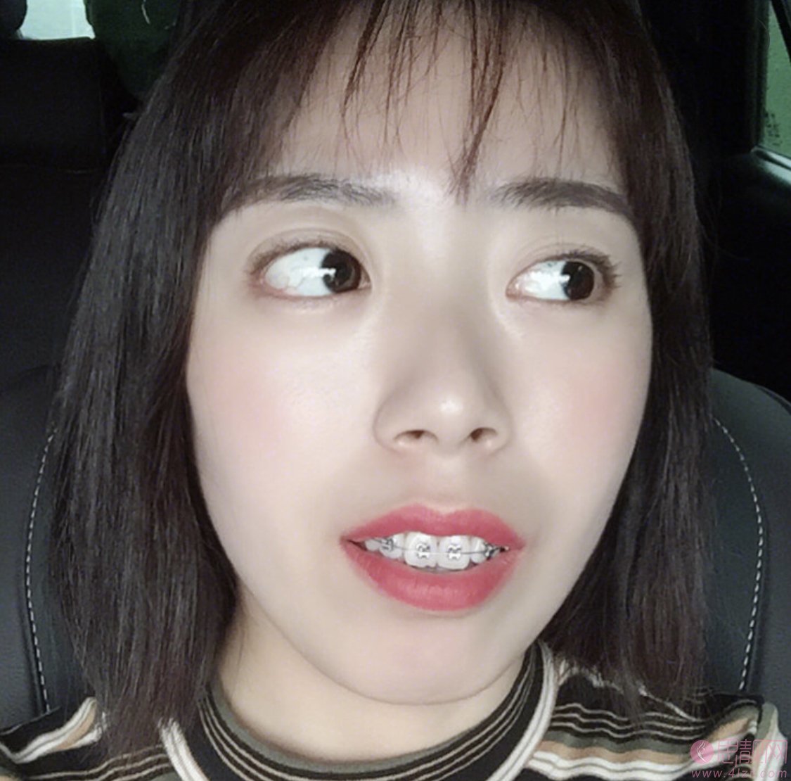 暨南大学附属雅皓口腔医院矫正牙齿怎么样？2020价格表一览