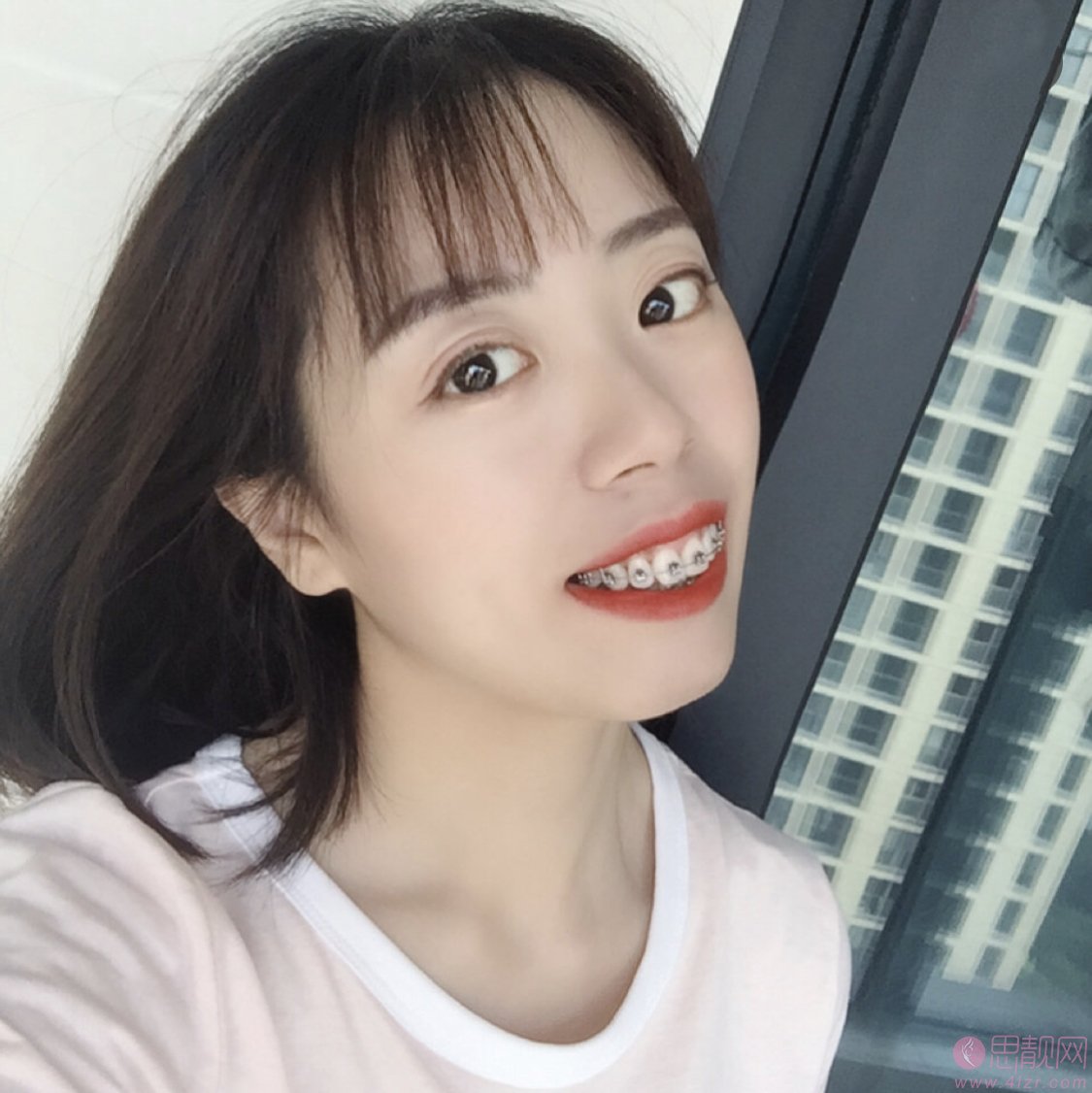 暨南大学附属雅皓口腔医院矫正牙齿怎么样？2020价格表一览