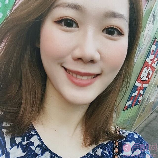 深圳微尔口腔牙齿美白怎么样?附美白拳皇对比效果及2020价格表一览