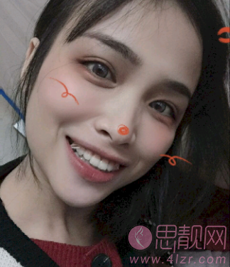 沈阳维尔口腔医院2020价格表全新上线+牙齿矫正前后对比案例
