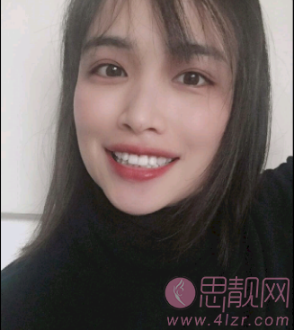 沈阳维尔口腔医院2020价格表全新上线+牙齿矫正前后对比案例