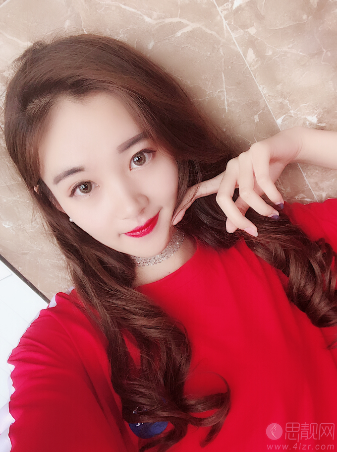 南京美范整形美容陈雪峰自体脂肪全脸填充怎么样？附填充案例对比及2020价格表一览